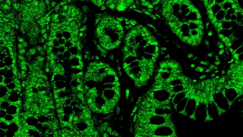 Tiny doses of THC show big benefits for HIV treatment